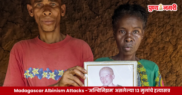 Madagascar Albinism Attacks : मादागास्करमध्ये डोळ्यांसाठी ‘अल्बिनिझम’ असलेल्या १३ मुलांचे हत्यासत्र