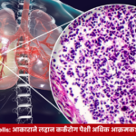 Small Cancer Cells दर्शवणारे वैज्ञानिक चित्र, ज्यात लहान पण अधिक आक्रमक होऊ शकणाऱ्या कर्करोग पेशी आणि ट्यूमरची वाढ दाखवली आहे.