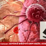Young-Onset Cancer – इंग्लंडमधील अभ्यासात ५० वर्षांखालील व्यक्तींमध्ये विविध प्रकारच्या कर्करोगांच्या वाढत्या प्रमाणाचा घेतलेला आढावा